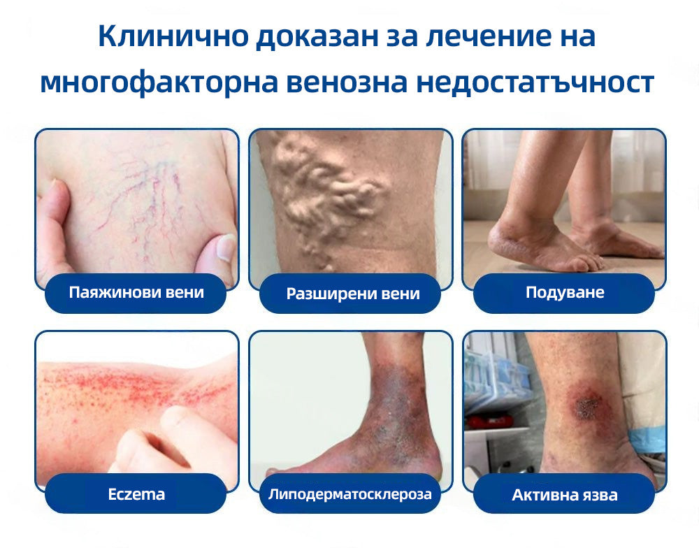 🇧🇬👨‍⚕️✅ 𝙃𝙚𝙖𝙡𝙧𝙞𝙯𝙚® 𝙑𝙚𝙞𝙣𝙏𝙖𝙧𝙜𝙚𝙩 микроиглена лепенка⚡ Незабавно облекчение, дълготрайни резултати📦