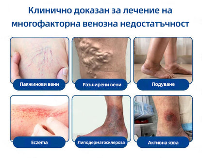 🇧🇬👨‍⚕️✅ 𝙃𝙚𝙖𝙡𝙧𝙞𝙯𝙚® 𝙑𝙚𝙞𝙣𝙏𝙖𝙧𝙜𝙚𝙩 микроиглена лепенка⚡ Незабавно облекчение, дълготрайни резултати📦