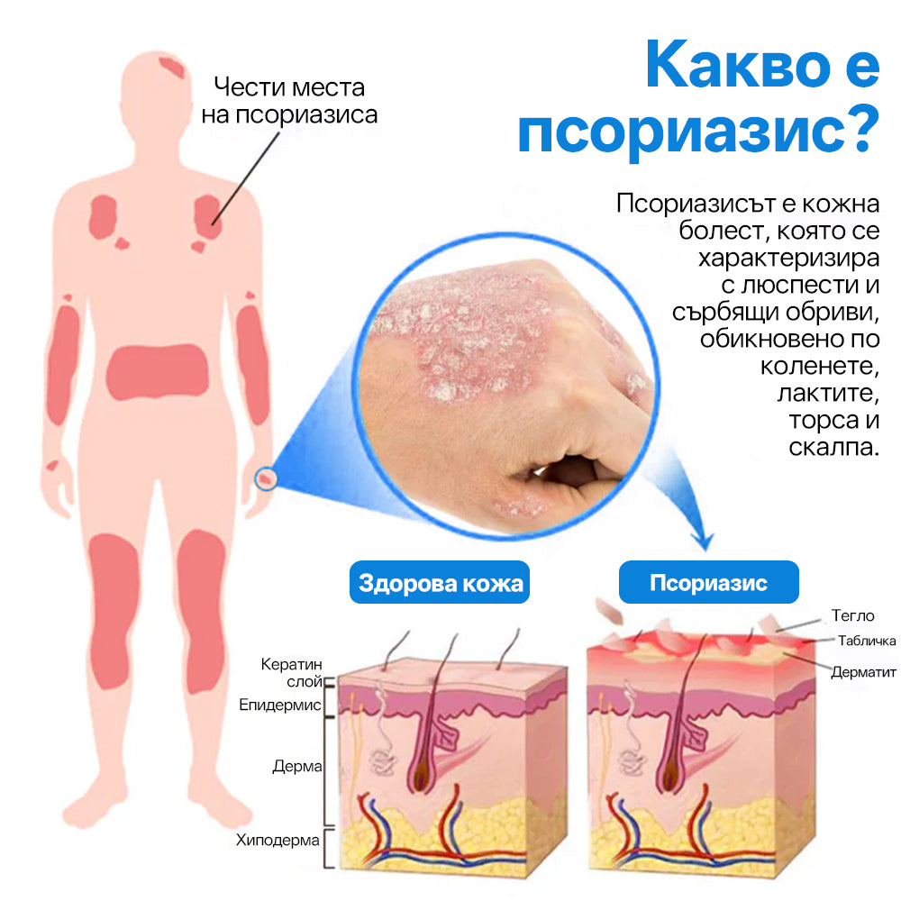 Zvoevo® Магнезиев билков спрей  – облекчение при псориазис, екзема, интимни бактериални инфекции, акне и тъмни петна📦