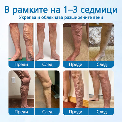 Timilk® VeinGuard Herbal Spray-Клинично доказано е, че премахва разширените вени само за 7 дни!✅