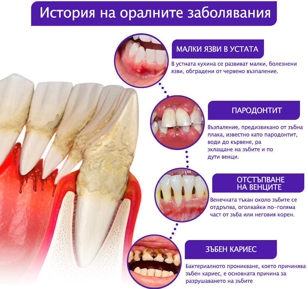 Паста за зъби Pureluxo® VioCore, съдържаща пчелна отрова – специално разработена за грижа за венците.✅