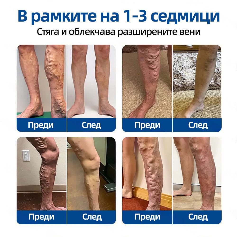 🇧🇬👨‍⚕️✅ 𝙃𝙚𝙖𝙡𝙧𝙞𝙯𝙚® 𝙑𝙚𝙞𝙣𝙏𝙖𝙧𝙜𝙚𝙩 микроиглена лепенка⚡ Незабавно облекчение, дълготрайни резултати📦