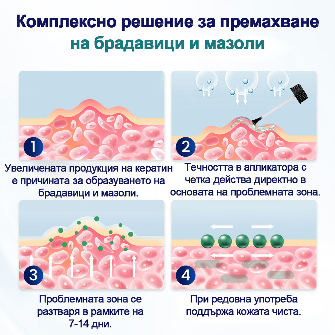 Течност за премахване на брадавици Timnik®WartLift
