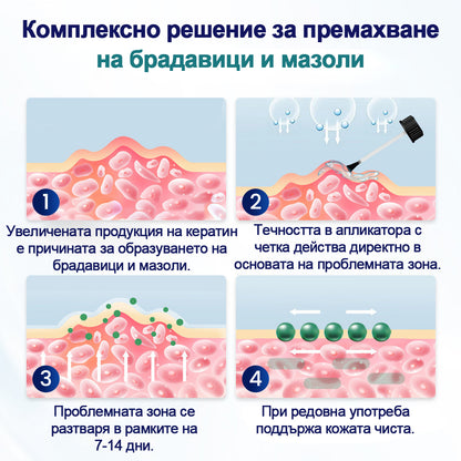 Течност за премахване на брадавици Timnik®WartLift