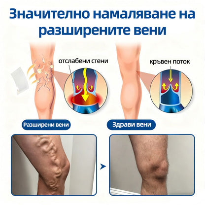 🇧🇬👨‍⚕️✅ 𝙃𝙚𝙖𝙡𝙧𝙞𝙯𝙚® 𝙑𝙚𝙞𝙣𝙏𝙖𝙧𝙜𝙚𝙩 микроиглена лепенка⚡ Незабавно облекчение, дълготрайни резултати📦