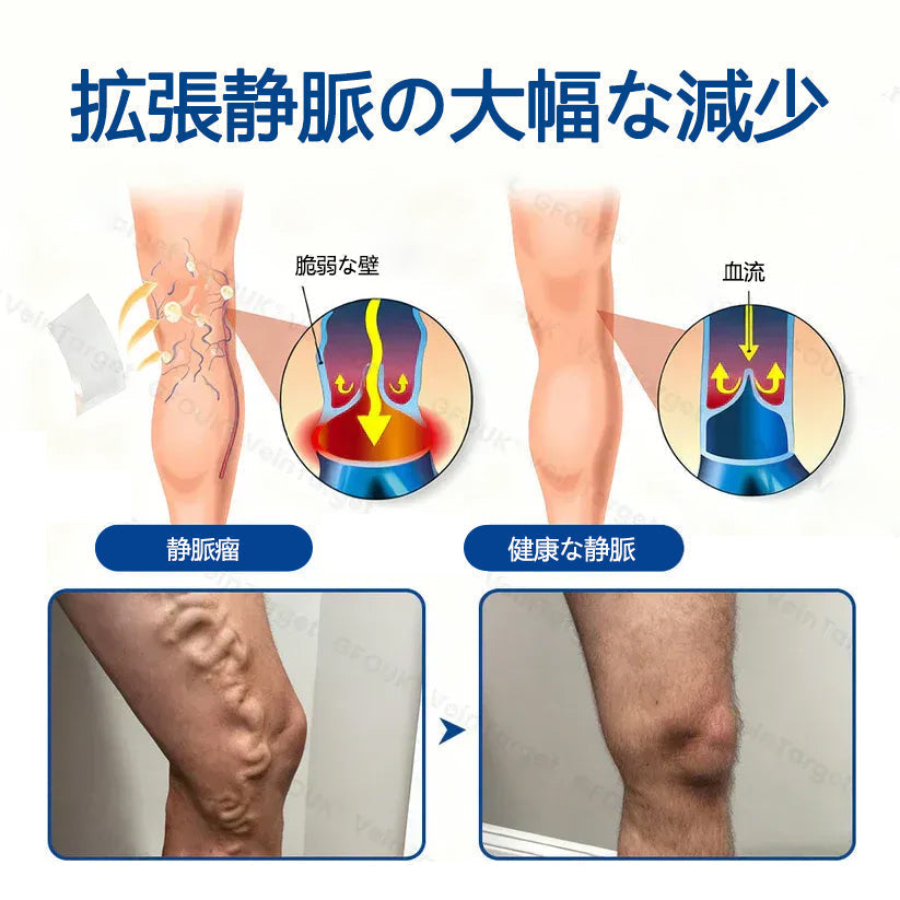 💎Healrize® ヴェインターゲット マイクロニードルパッチ⭐️