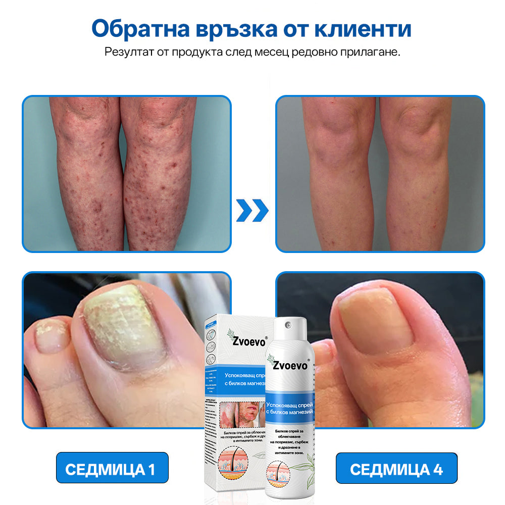 Zvoevo® Магнезиев билков спрей  – облекчение при псориазис, екзема, интимни бактериални инфекции, акне и тъмни петна📦