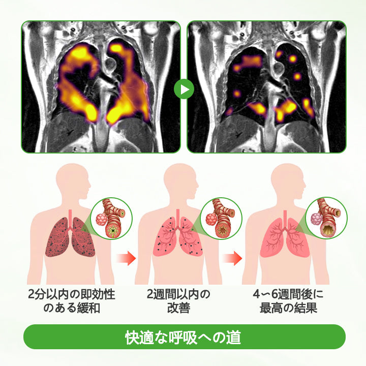 🔥🔥🔥🔥🔥CleraNaure® HerbaAir マルリン肺浄化剤