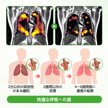 🔥🔥🔥🔥🔥CleraNaure® HerbaAir マルリン肺浄化剤