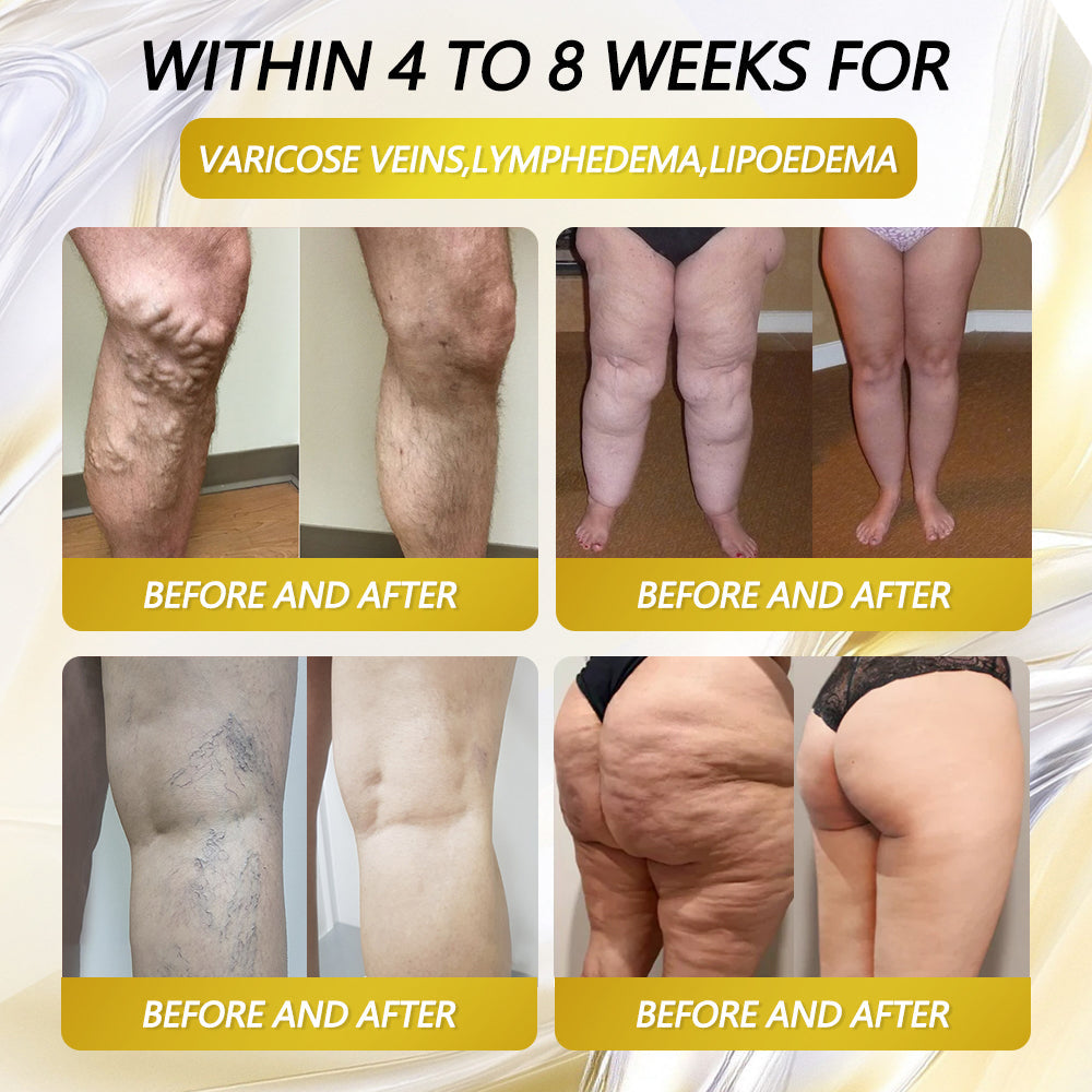 CleraLuxe® AMPK Metabolism Activating Patches – Enriched with plant extracts such as EGCG and berberine, these patches help block carbohydrate absorption and burn fat. See results in just 7 days! 🎁🎁