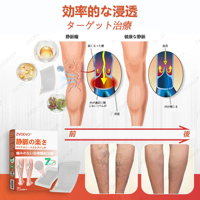 ☘️【厚生労働省認可・GMP準拠】Zvoevo® Vein Ease マイクロニードルケアパッチ（クモ状静脈・静脈瘤・むくみ・脚の疲れに）📦