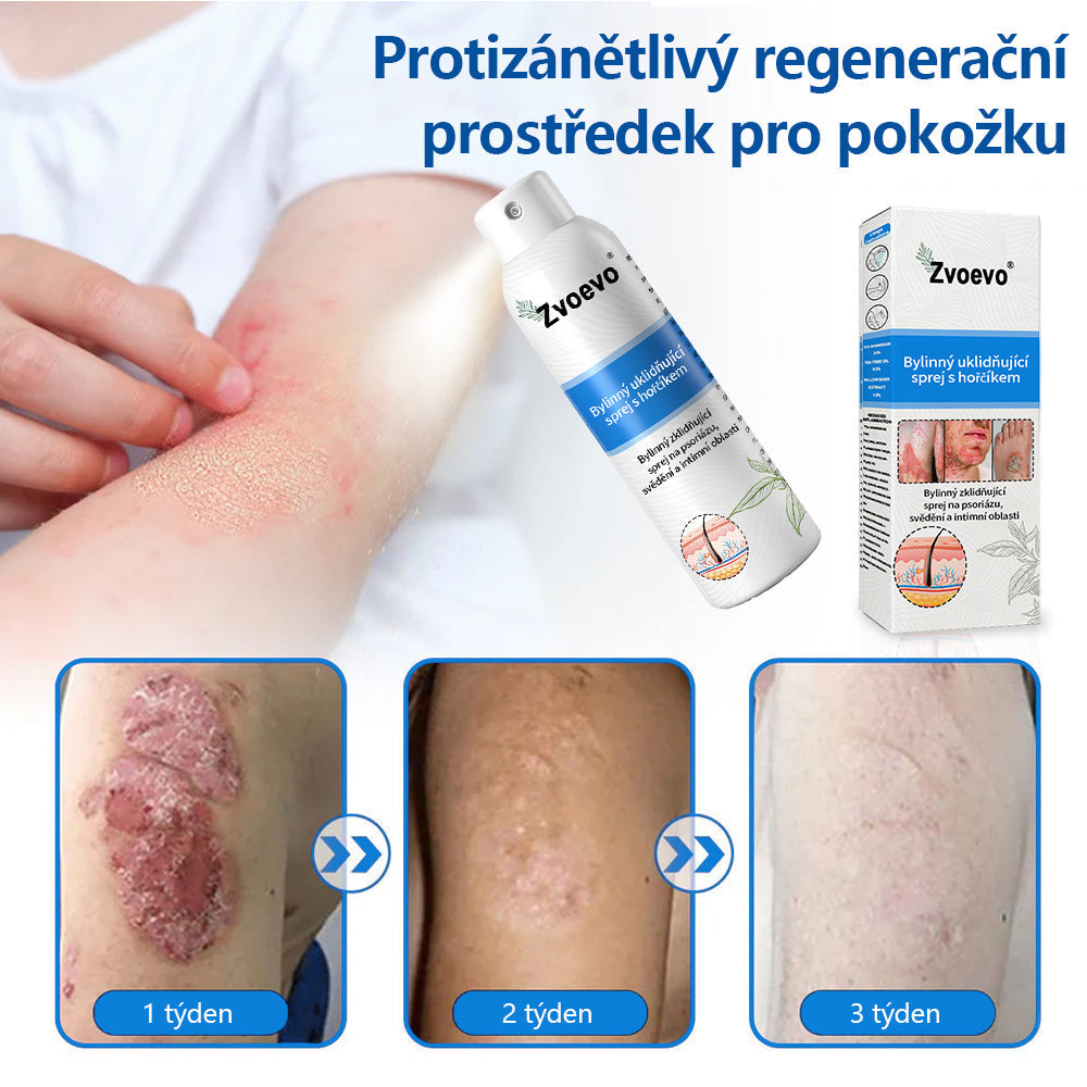 Zvoevo® Магнезиев билков спрей  – облекчение при псориазис, екзема, интимни бактериални инфекции, акне и тъмни петна📦