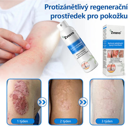 Zvoevo® Магнезиев билков спрей  – облекчение при псориазис, екзема, интимни бактериални инфекции, акне и тъмни петна📦