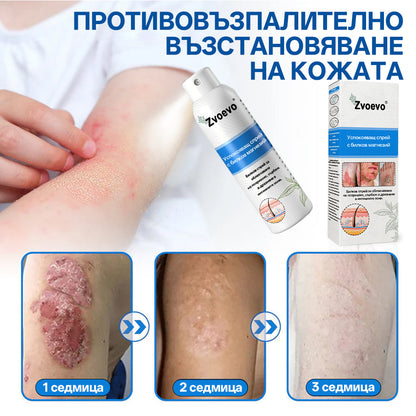 Zvoevo® Магнезиев билков спрей  – облекчение при псориазис, екзема, интимни бактериални инфекции, акне и тъмни петна📦