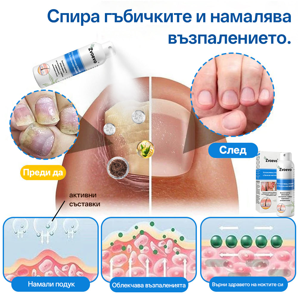 Zvoevo® Магнезиев билков спрей  – облекчение при псориазис, екзема, интимни бактериални инфекции, акне и тъмни петна📦