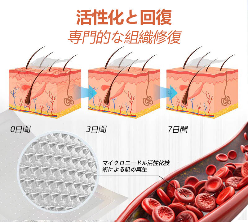 ☘️【厚生労働省認可・GMP準拠】Zvoevo® Vein Ease マイクロニードルケアパッチ（クモ状静脈・静脈瘤・むくみ・脚の疲れに）📦